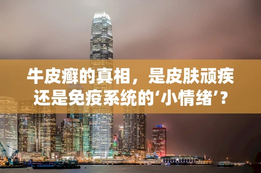 牛皮癣的真相，是皮肤顽疾还是免疫系统的‘小情绪’？
