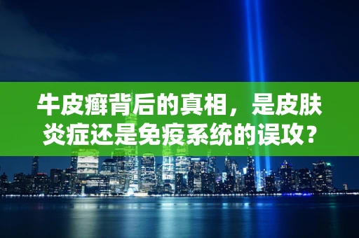 牛皮癣背后的真相，是皮肤炎症还是免疫系统的误攻？