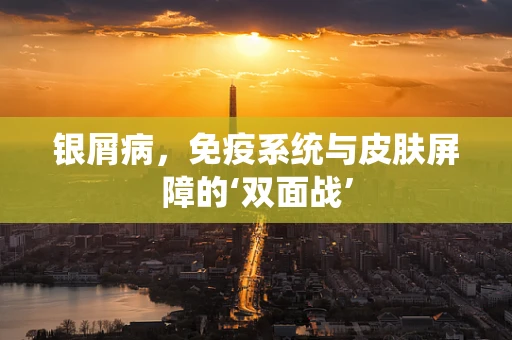 银屑病，免疫系统与皮肤屏障的‘双面战’