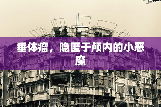 垂体瘤，隐匿于颅内的小恶魔
