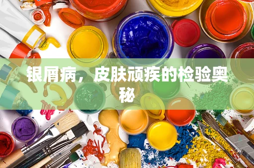 银屑病，皮肤顽疾的检验奥秘