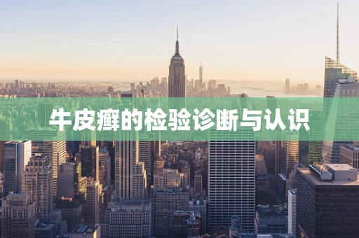 牛皮癣的检验诊断与认识