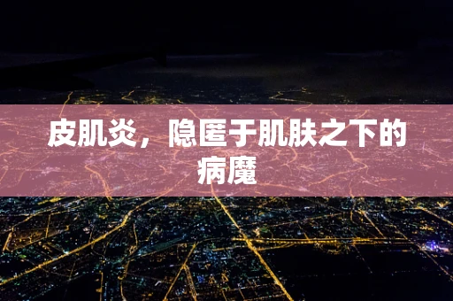 皮肌炎，隐匿于肌肤之下的病魔